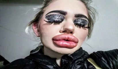 Това жена ли е или Франкенщайн на пластичната хирургия 8211