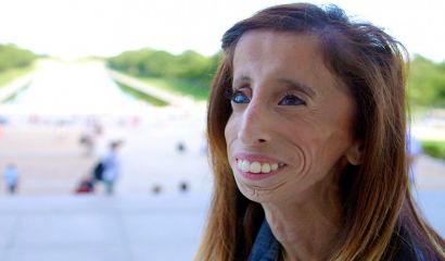 Лизи Веласкес е на 31 години и тежи едва 29