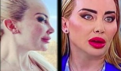 Корекциите по лицето на някогашната Мис България Антония Петрова спокойно